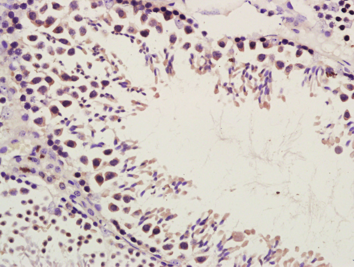 14 - Phospho1 Rabbit pAb AP54888