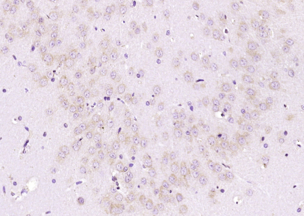14 - ABH1 Rabbit pAb AP54890