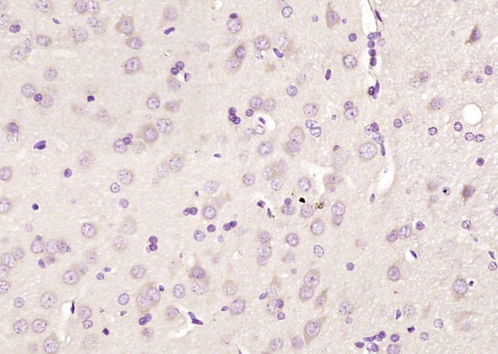 14 - beta B1 Crystallin Rabbit pAb AP54893