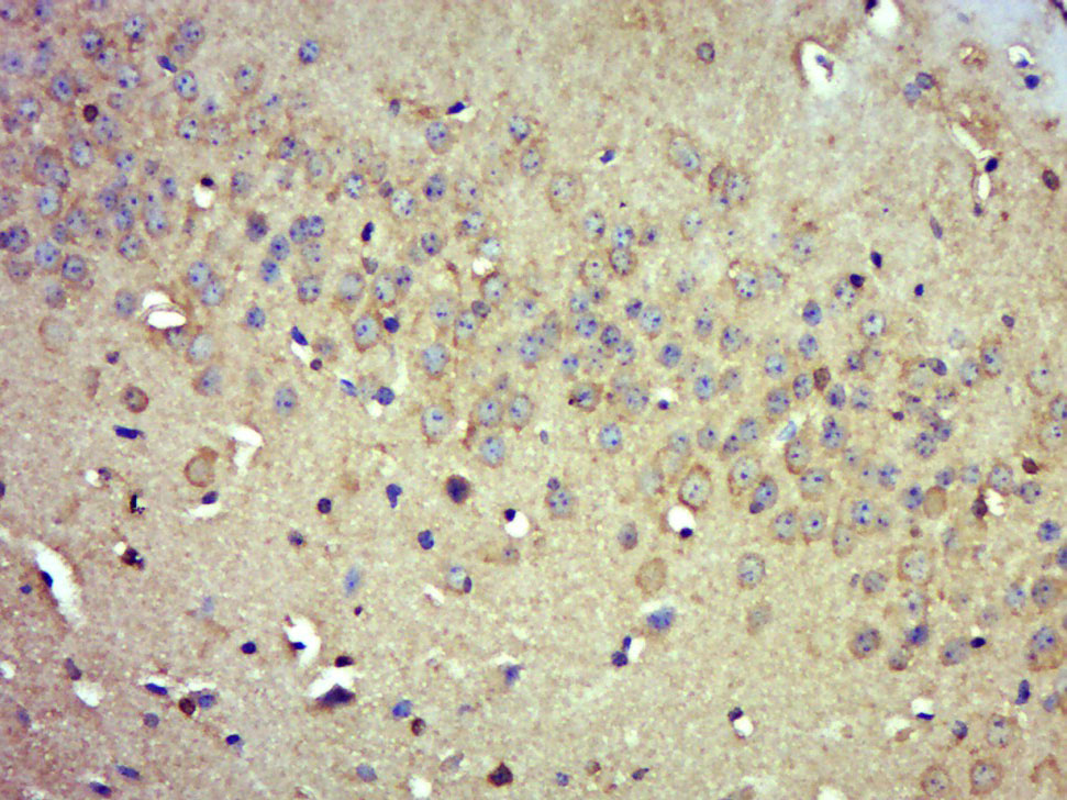 14 - PDE9A Rabbit pAb AP54895