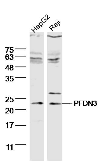 1 - PFDN3 Rabbit pAb AP54909