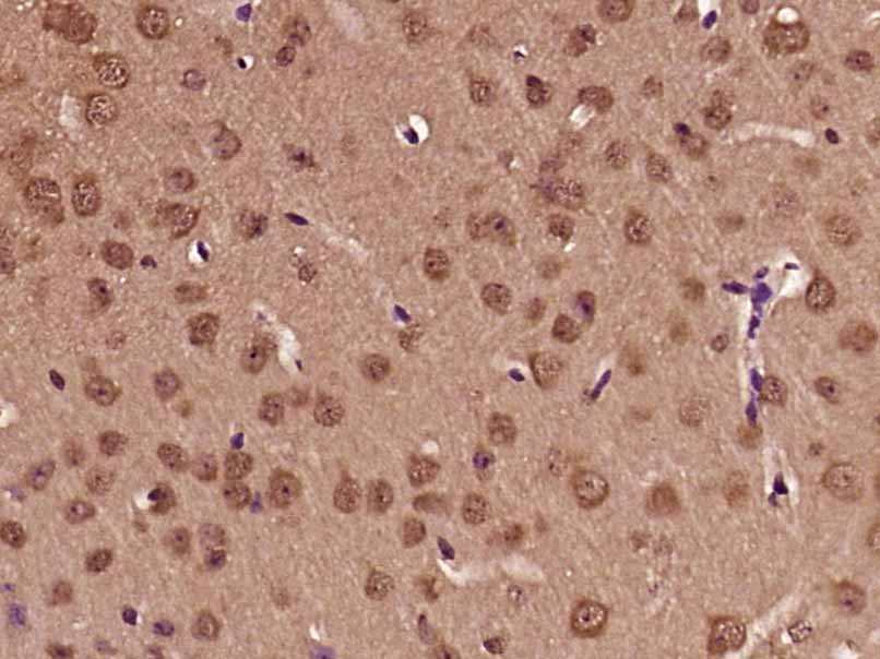 14 - PFDN3 Rabbit pAb AP54909