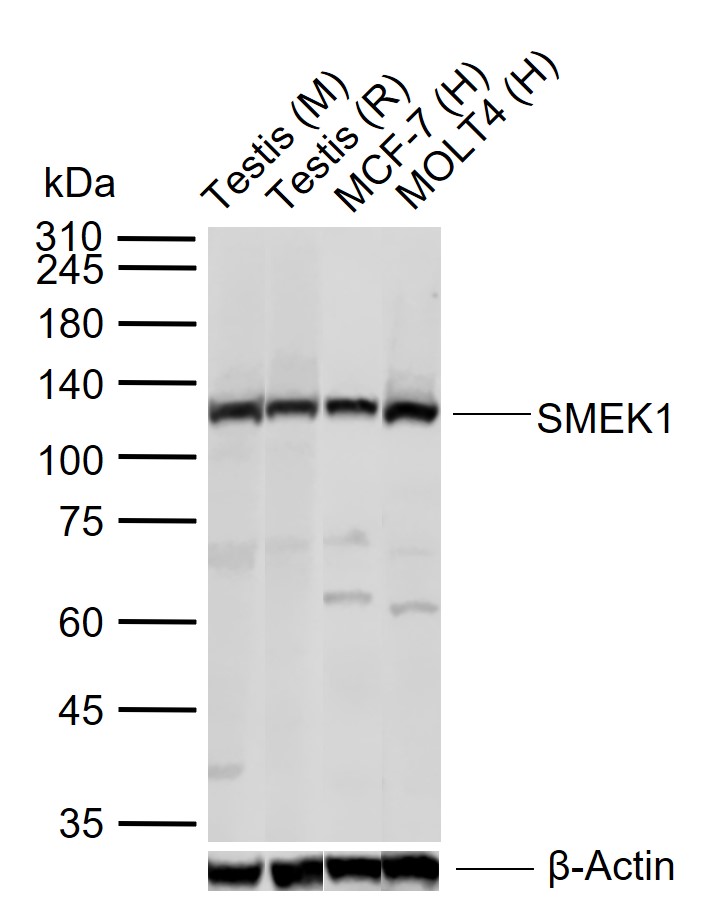 1 - SMEK1 Rabbit pAb AP54914