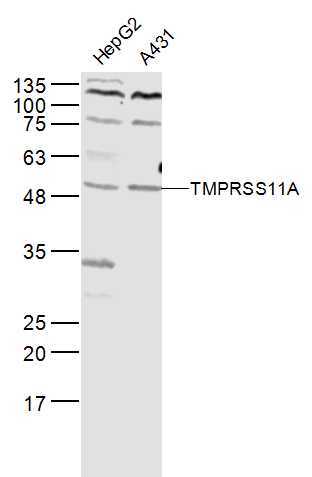 1 - TMPRSS11A Rabbit pAb AP54928