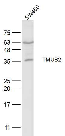 1 - TMUB2 Rabbit pAb AP54931
