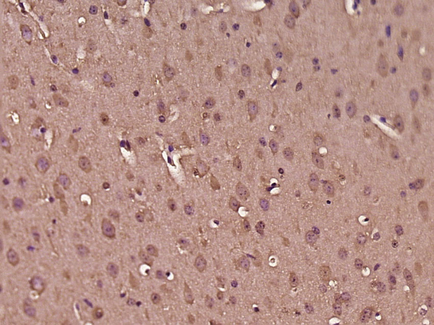 14 - PKIB Rabbit pAb AP54937