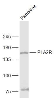 1 - PLA2R Rabbit pAb AP54940