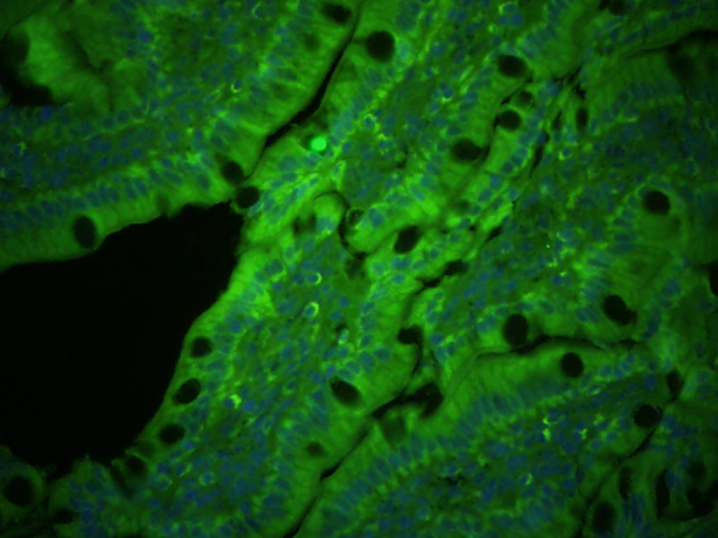 3 - PLVAP Rabbit pAb AP54949