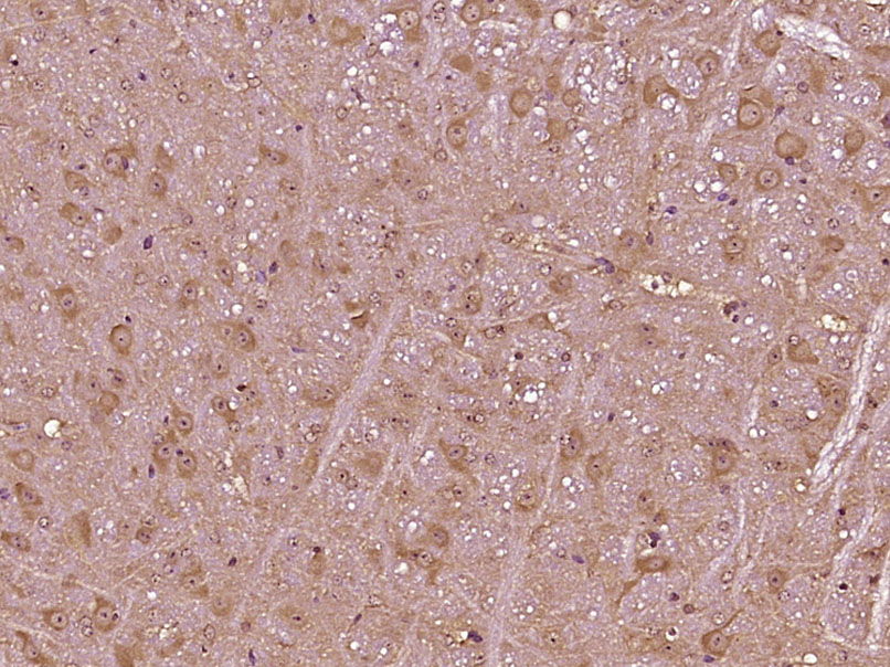 14 - VPS13D Rabbit pAb AP54958