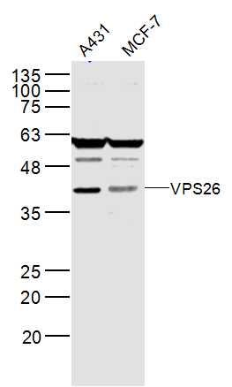 1 - VPS26 Rabbit pAb AP54959