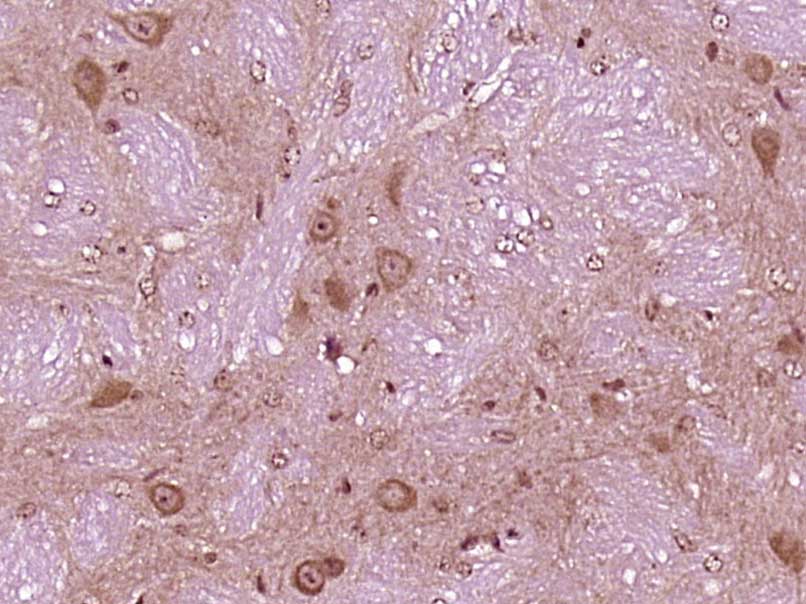 14 - VPS29 Rabbit pAb AP54961