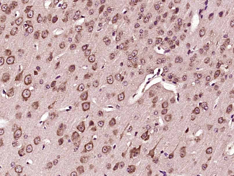 14 - VPS33B Rabbit pAb AP54962
