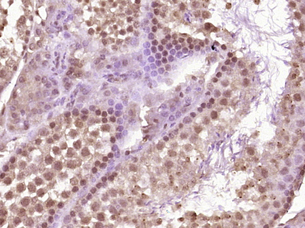 14 - VRTN Rabbit pAb AP54967