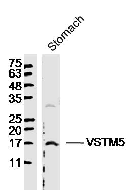 1 - VSTM5 Rabbit pAb AP54969