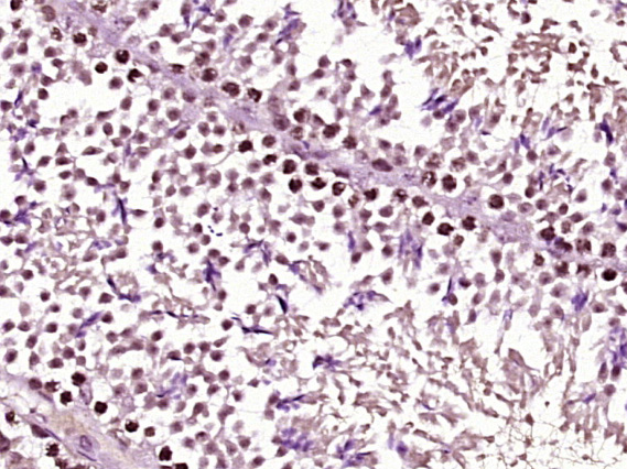 14 - ZNF182 Rabbit pAb AP54972