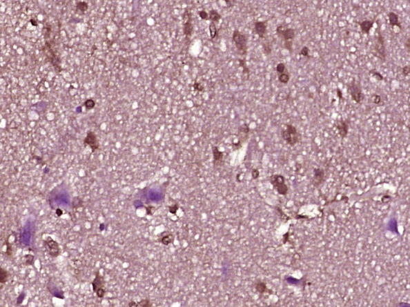14 - ZNF214 Rabbit pAb AP54978