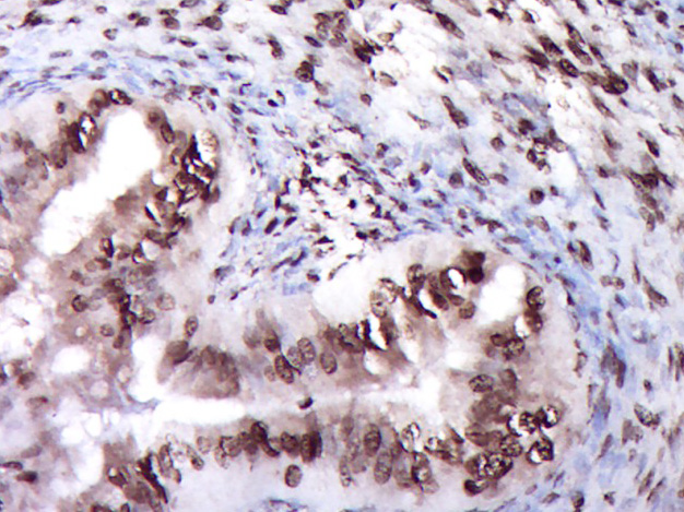 14 - ZNF22 Rabbit pAb AP54980