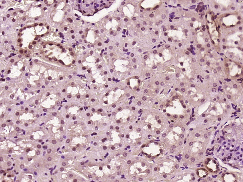 14 - ZNF496 Rabbit pAb AP54988