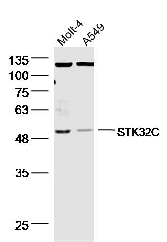 1 - STK32C Rabbit pAb AP54996