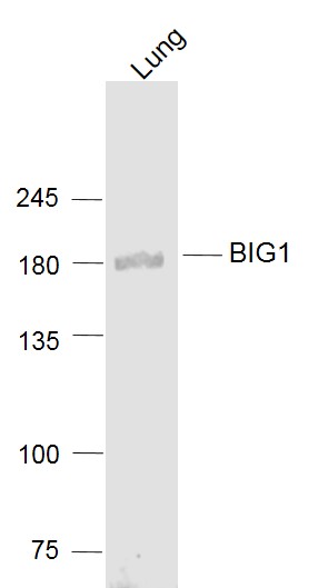 1 - BIG1 Rabbit pAb AP55005