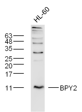 1 - BPY2 Rabbit pAb AP55012