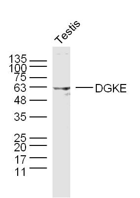 1 - DGKE Rabbit pAb AP55036