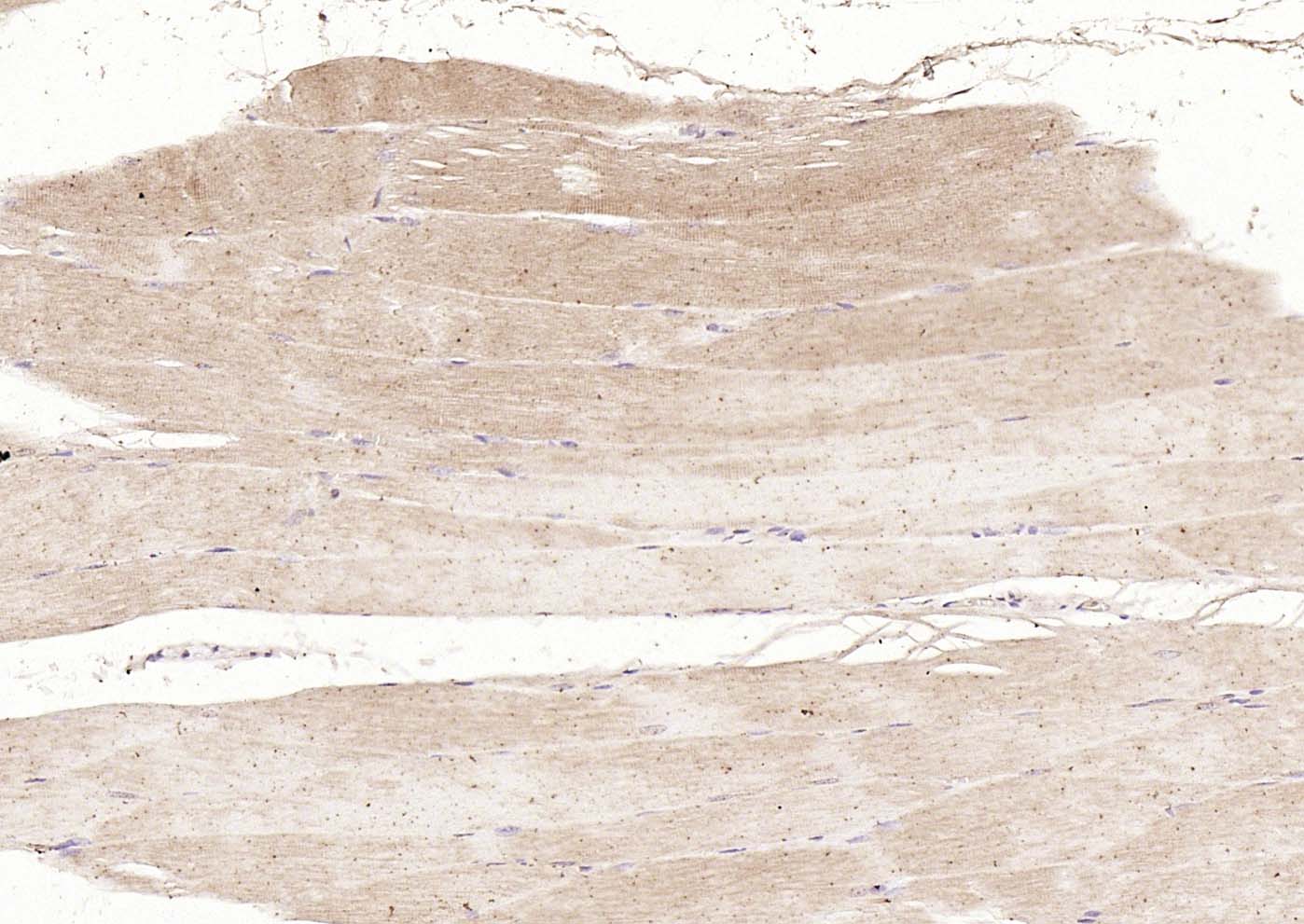 14 - DLST Rabbit pAb AP55039