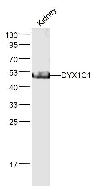1 - DYX1C1 Rabbit pAb AP55046