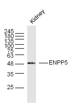 1 - ENPP5 Rabbit pAb AP55055