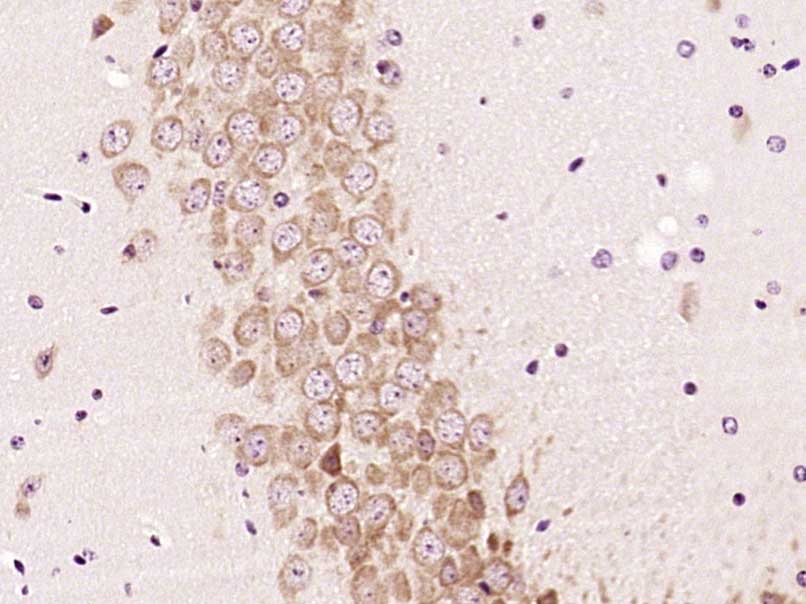 14 - EXOC2 Rabbit pAb AP55066