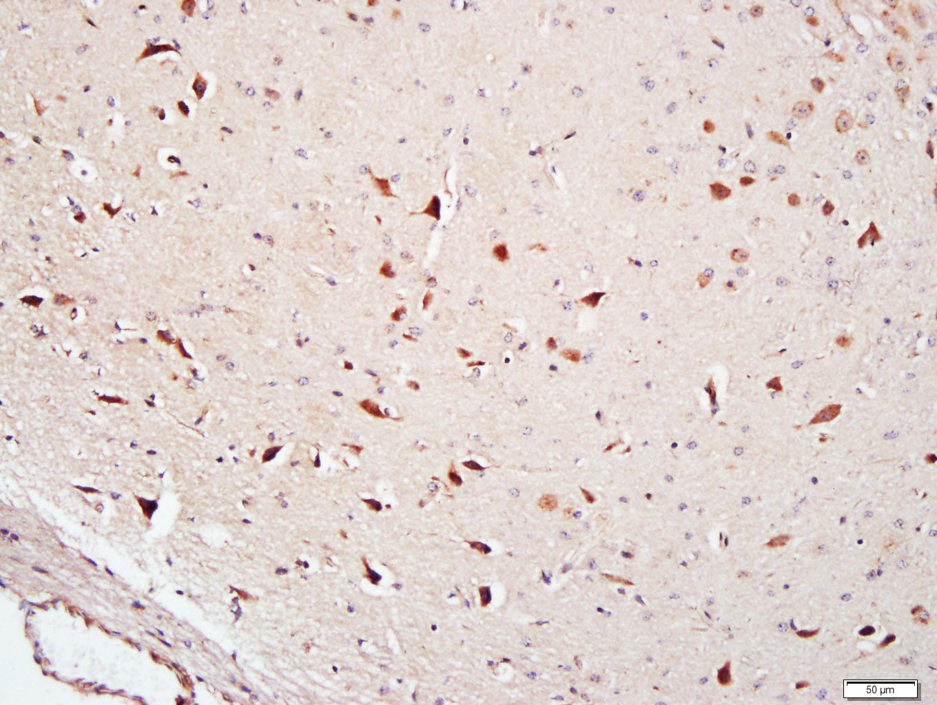 14 - FAM134B Rabbit pAb AP55070
