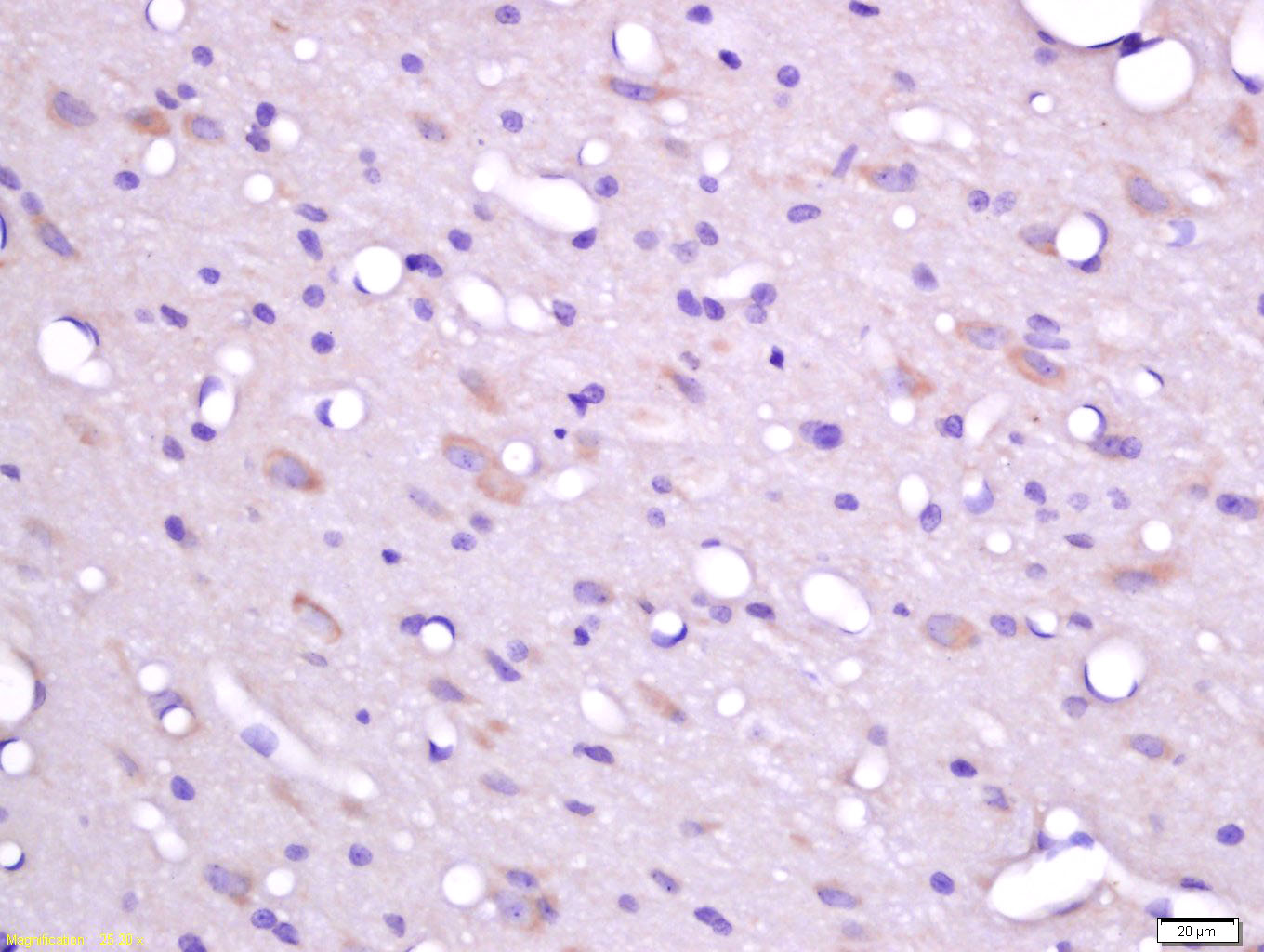 14 - FHOD3 Rabbit pAb AP55074