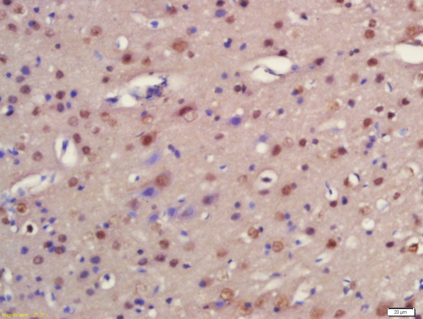 14 - FNIP1 Rabbit pAb AP55088