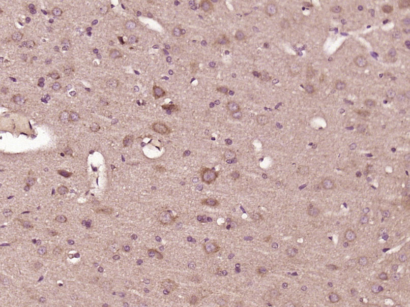 14 - FSD1 Rabbit pAb AP55095
