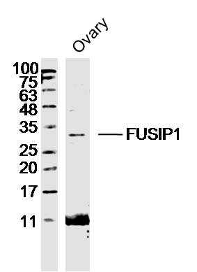 1 - FUSIP1 Rabbit pAb AP55099