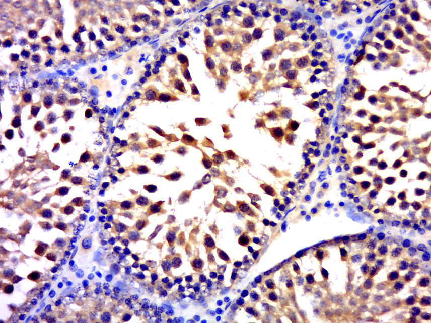 14 - FUSIP1 Rabbit pAb AP55099