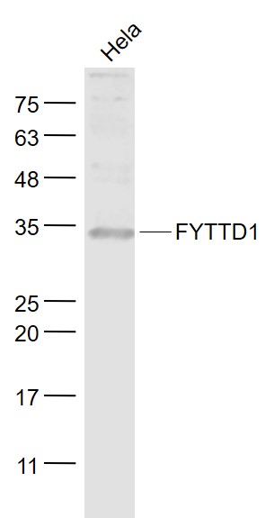 1 - FYTTD1 Rabbit pAb AP55103