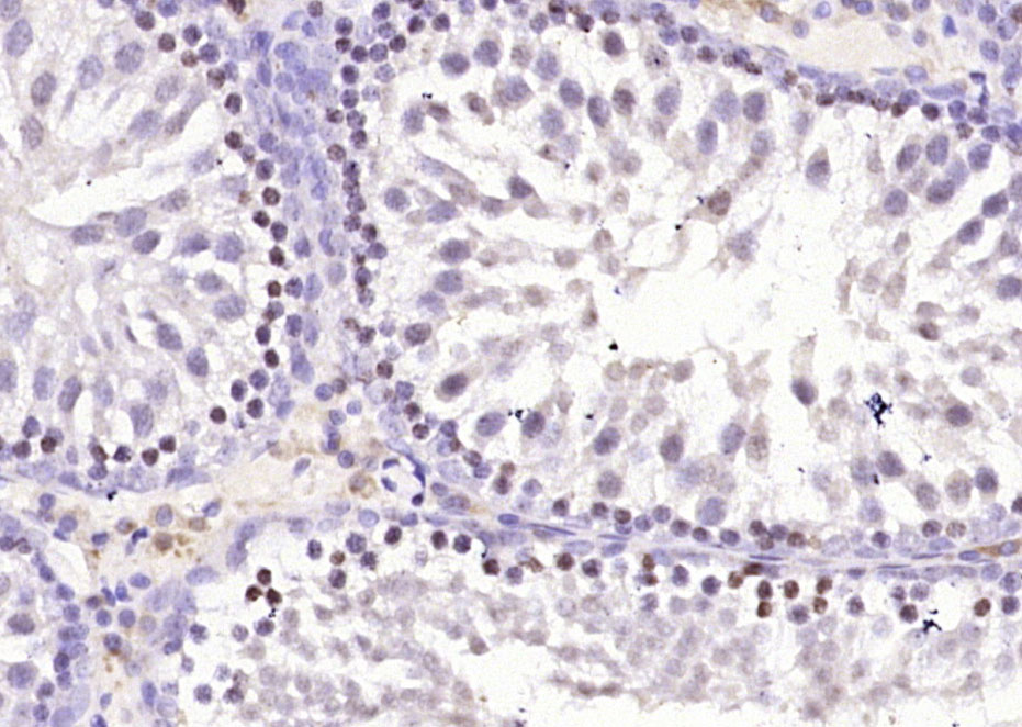 14 - FYTTD1 Rabbit pAb AP55103