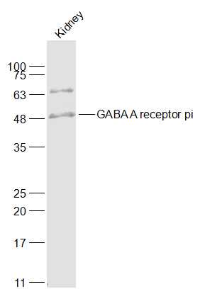 1 - GABA A receptor pi Rabbit pAb AP55108