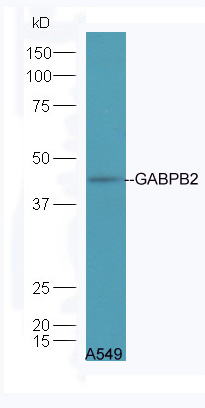 1 - GABPB2 Rabbit pAb AP55111