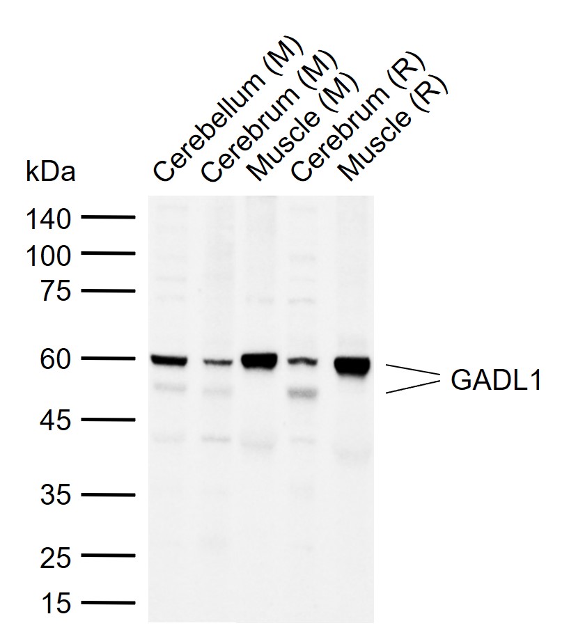 1 - GADL1 Rabbit pAb AP55112