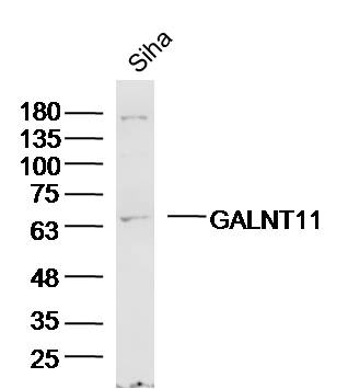 1 - GALNT11 Rabbit pAb AP55116