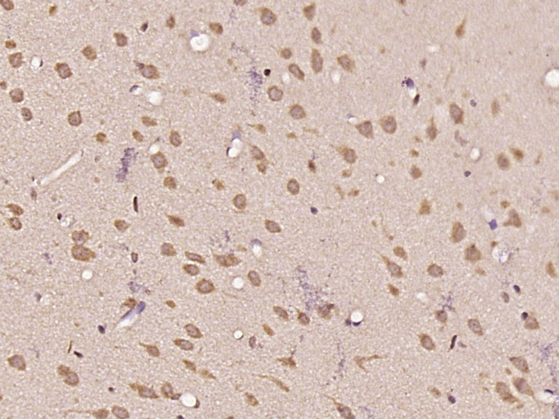 14 - GALNT11 Rabbit pAb AP55116