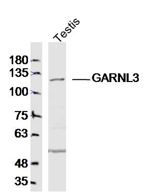 1 - GARNL3 Rabbit pAb AP55121