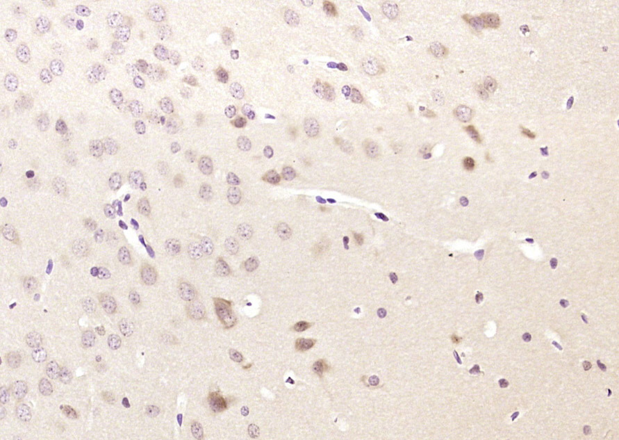 14 - GARNL1 Rabbit pAb AP55122