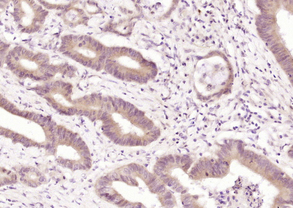 14 - Gemin 4 Rabbit pAb AP55134