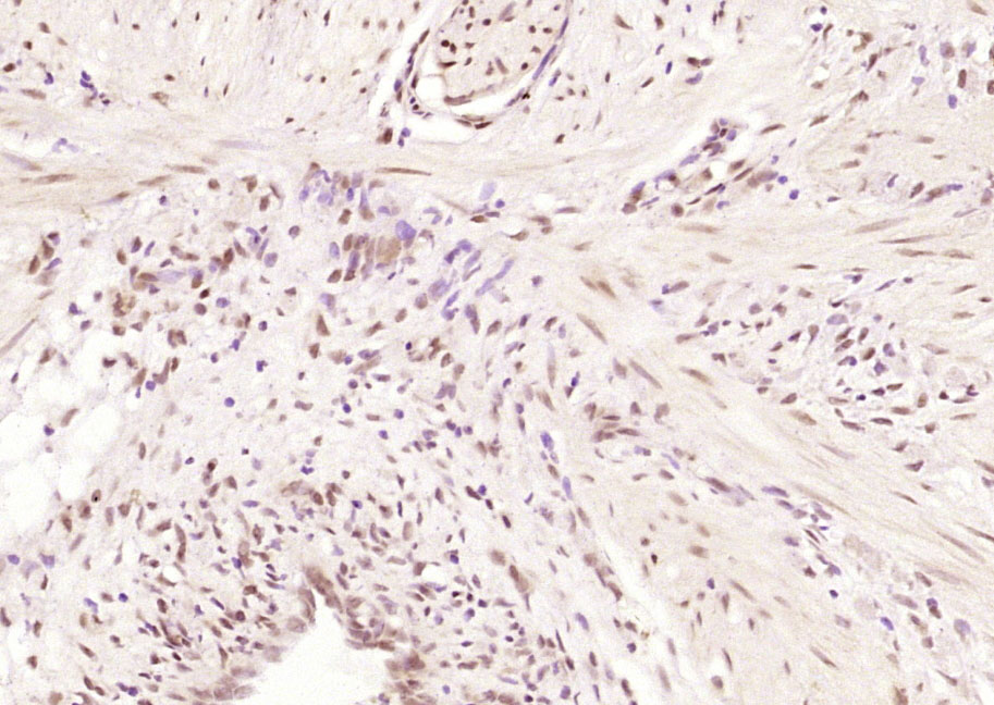 14 - GEM Rabbit pAb AP55136