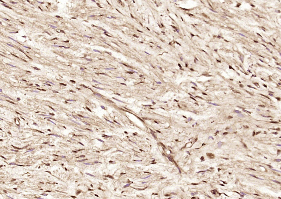 14 - Gemin 6 Rabbit pAb AP55138