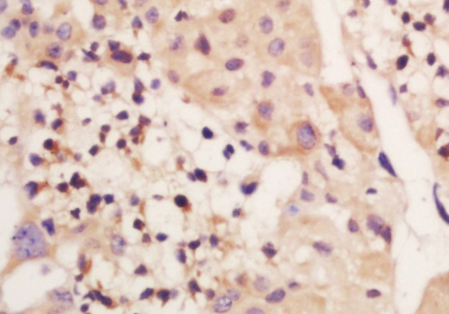 14 - Genethonin 1 Rabbit pAb AP55139