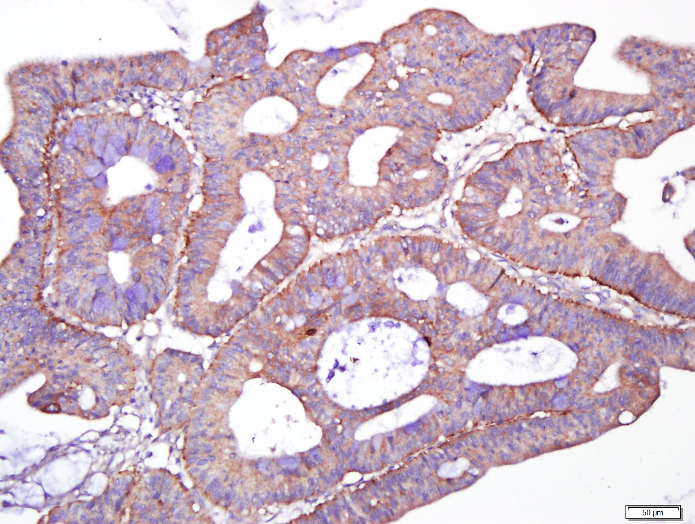 14 - Giantin Rabbit pAb AP55144